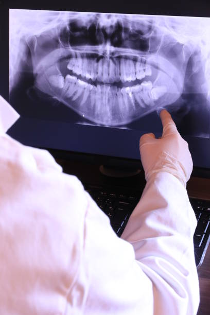Best Emergency Dental Surgery in White Settlement, TX