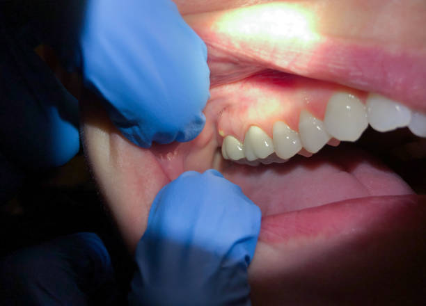 Best After-Hours Emergency Dentist in White Settlement, TX