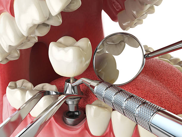 Best Walk-In Emergency Dentist in White Settlement, TX